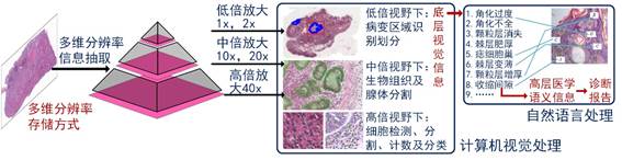 说明:图11